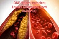 Cholesterol level